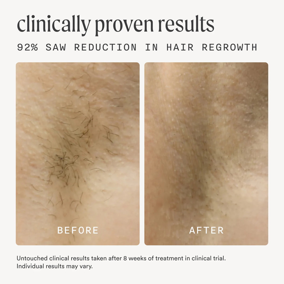 the flasher 2.0 + the nood serum